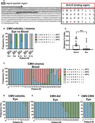 Intraocular human cytomegaloviruses of ocular diseases are distinct from those of viremia and are capable of escaping from innate and adaptive immunity by exploiting HLA-E-mediated peripheral and central tolerance